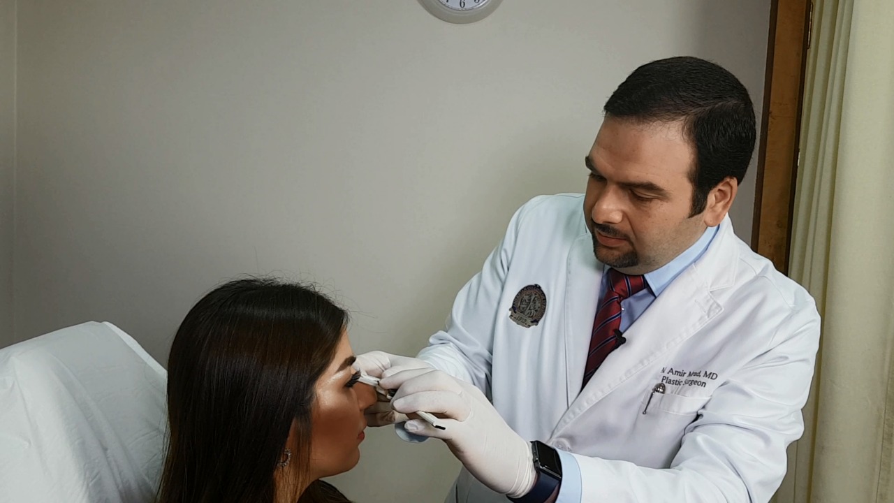 نتيجة عملية تجميل الأنف (الخشم) في الرياض مع د. أمير مراد