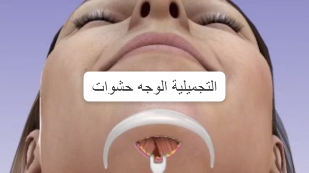 حشوات الوجه التجميلية