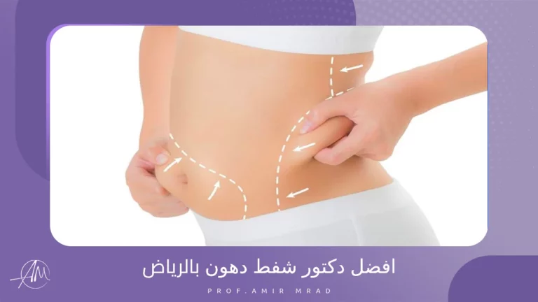 افضل دكتور شفط دهون بالرياض
