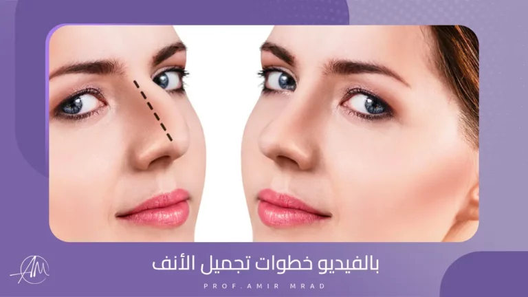 بالفيديو خطوات تجميل الأنف
