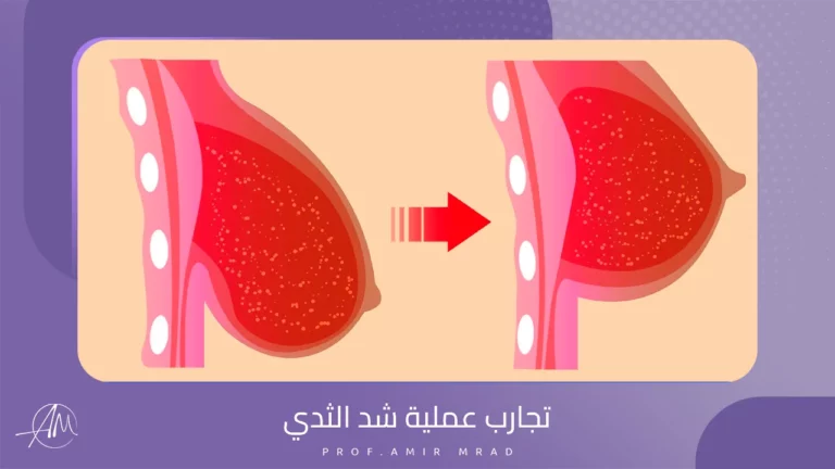 تجارب عملية شد الثدي