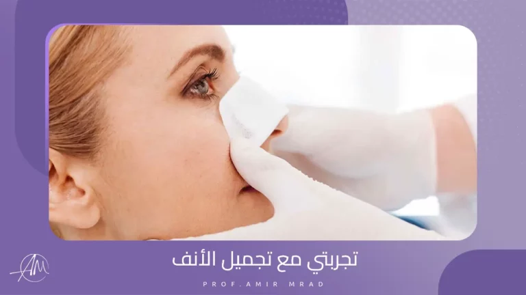 تجربتي مع عملية تجميل الأنف