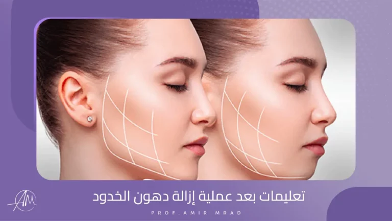 تعليمات بعد عملية إزالة دهون الخدود