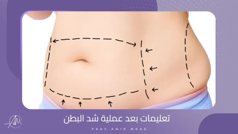 تعليمات بعد عملية شد البطن