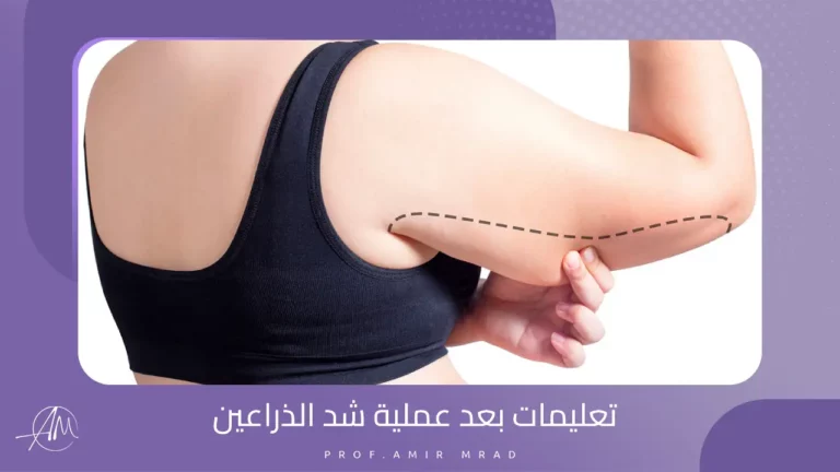 تعليمات بعد عملية شد الذراعين