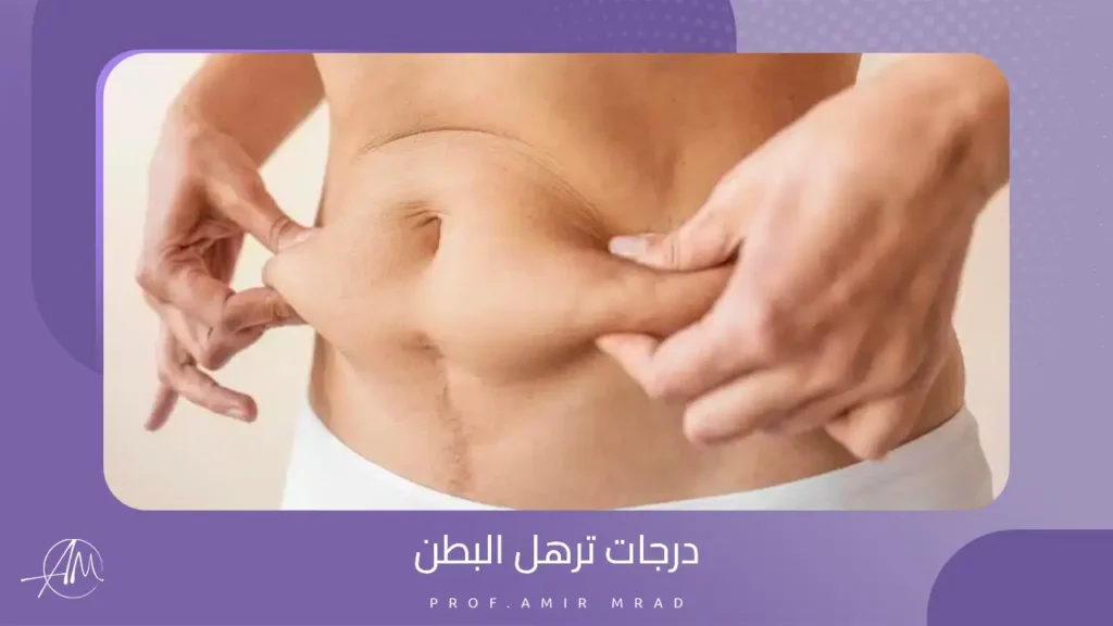 درجات ترهل البطن