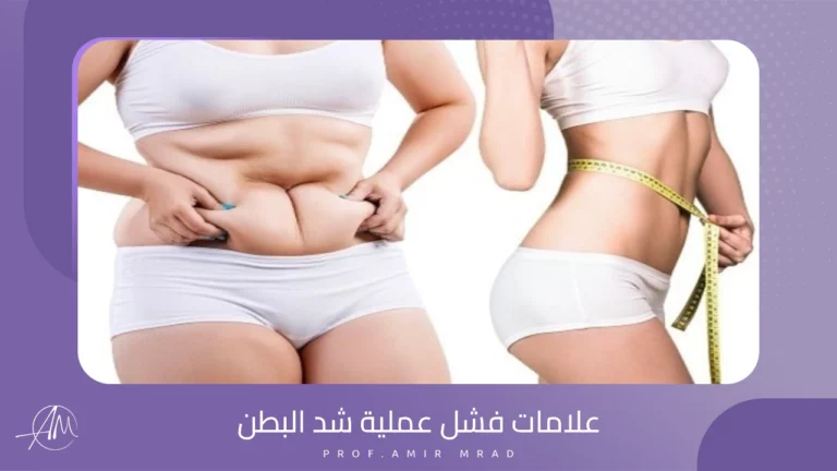 علامات فشل عملية شد البطن