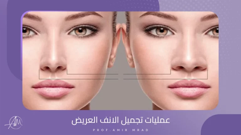 عمليات تجميل الانف العريض