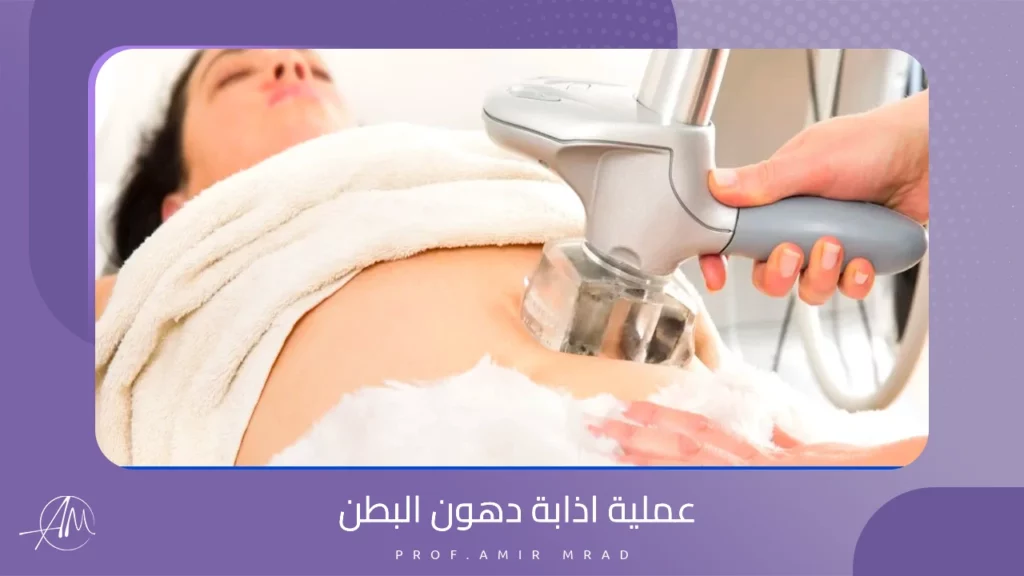 عملية اذابة دهون البطن