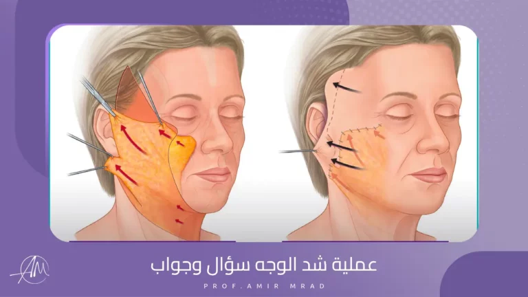 عملية-شد-الوجه-سؤال-وجواب