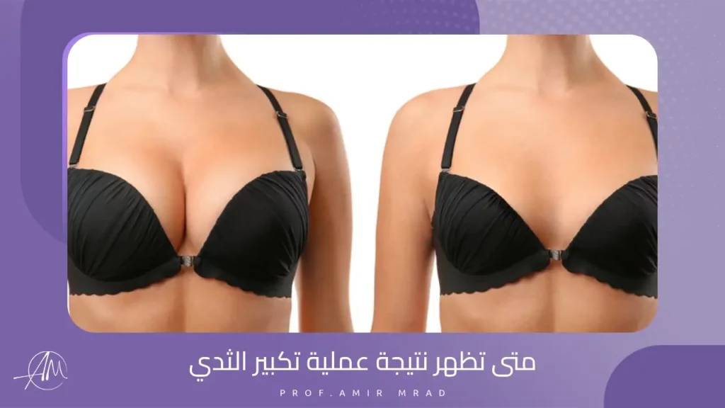 متى تظهر نتيجة عملية تكبير الثدي