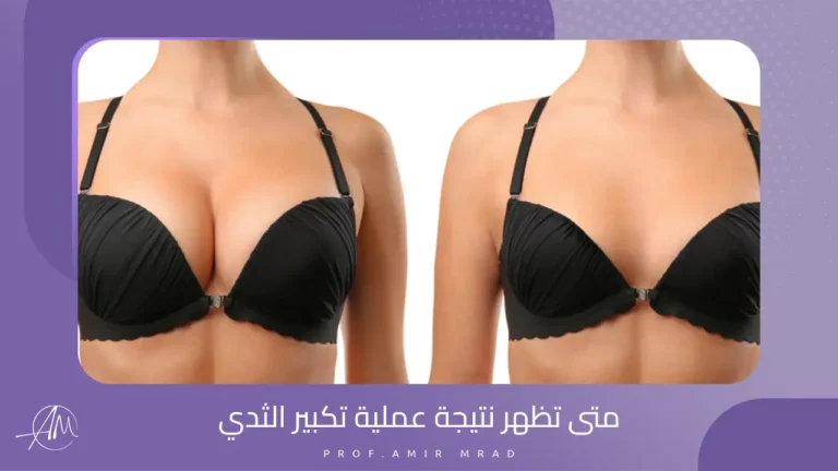 متى تظهر نتيجة عملية تكبير الثدي