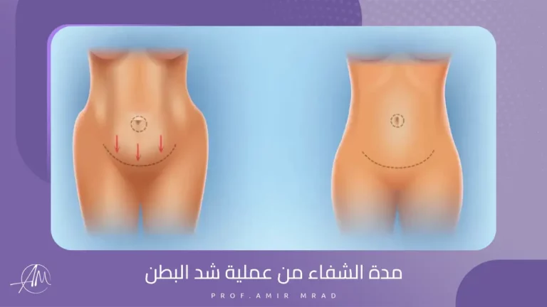 مدة الشفاء من عملية شد البطن