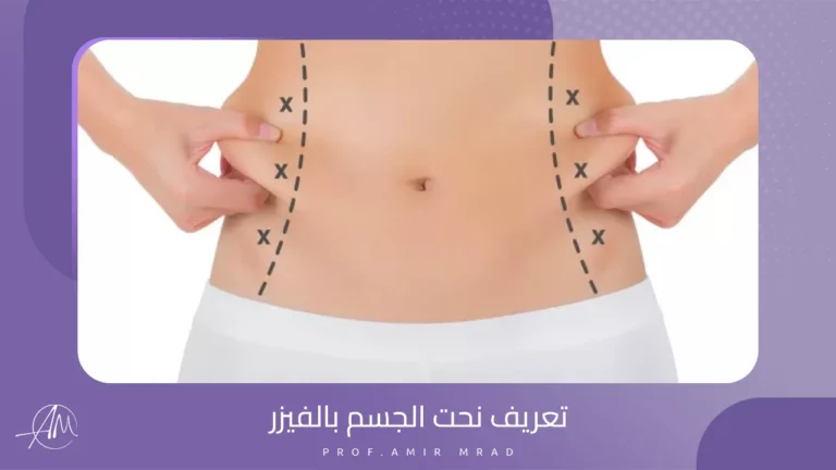 نحت الجسم بالفيزر